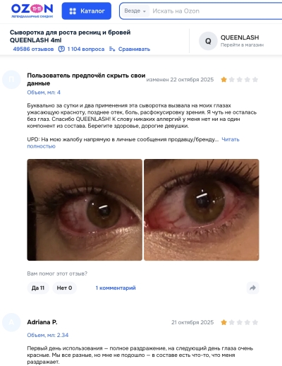 Queenlash отзывы: комедия ошибок и опасность для здоровья